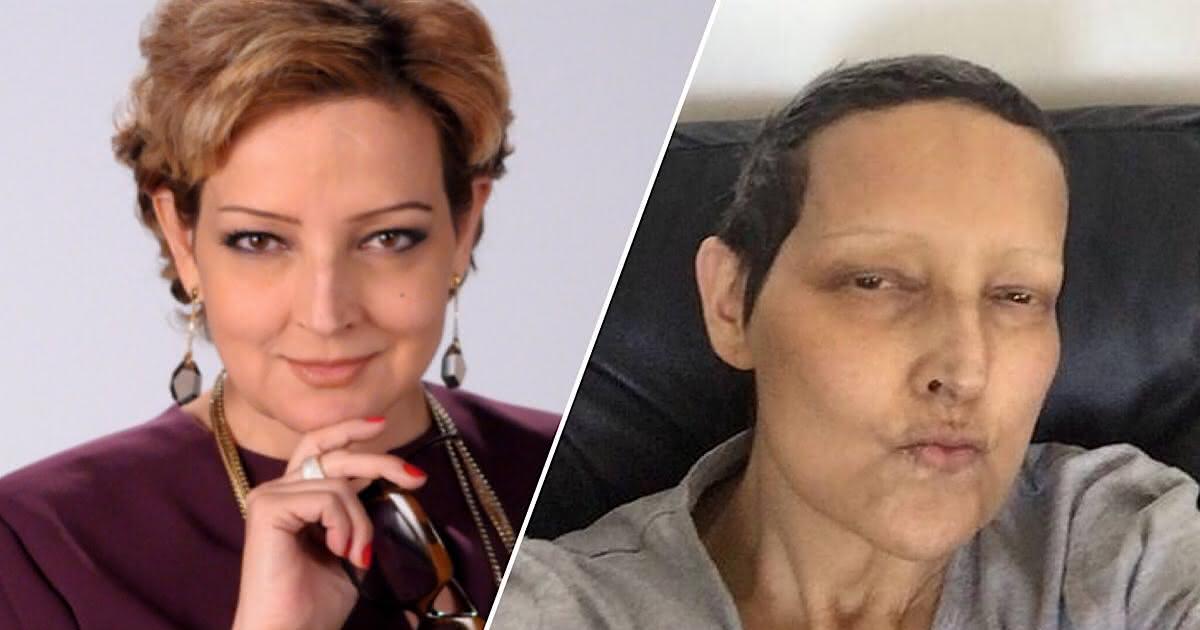 Atriz Beth Lago Faleceu Aos 60 Anos Vitima De Um Cancer2151671 · Momento Tv
